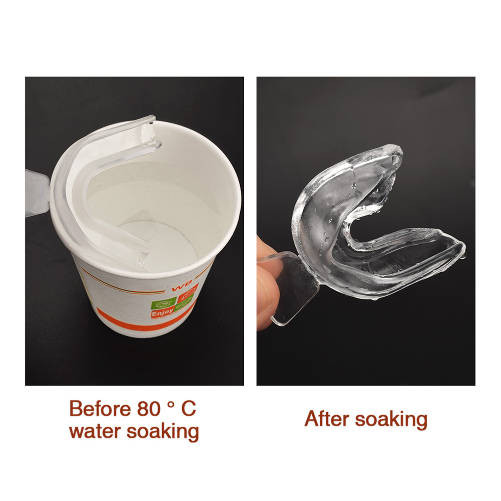 2-10pcs Silicone Mouth Guard O - Teeth Whitening With Braces ulasan dan harga