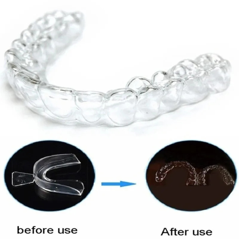 1/3/6pairs Silicone Mouth Guar - Teeth Whitening With Braces ulasan dan harga