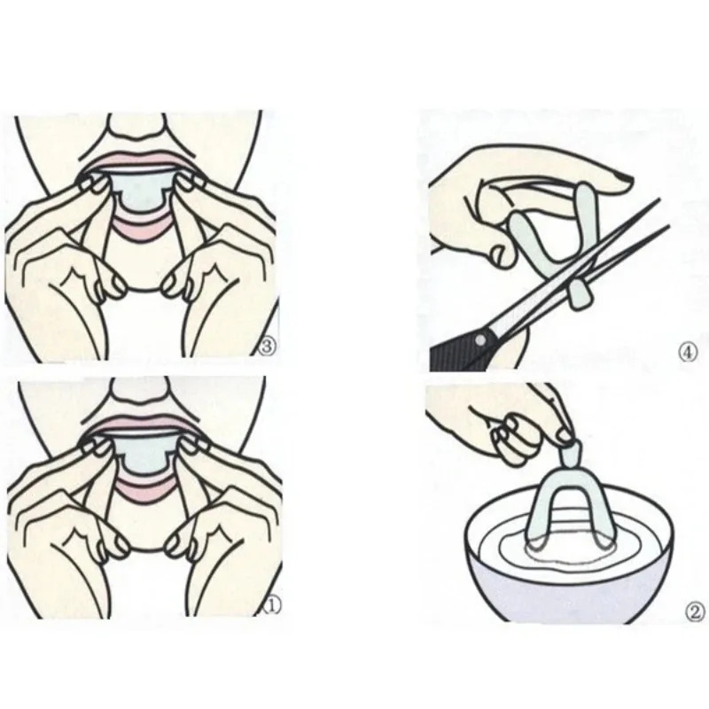 1/3/6pairs Silicone Mouth Guar - Teeth Whitening With Braces ulasan dan harga
