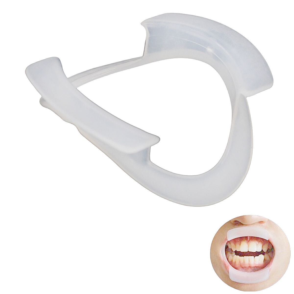 100pcs/bag Dental O-Shape Intr - Teeth Whitening With Braces ulasan dan harga