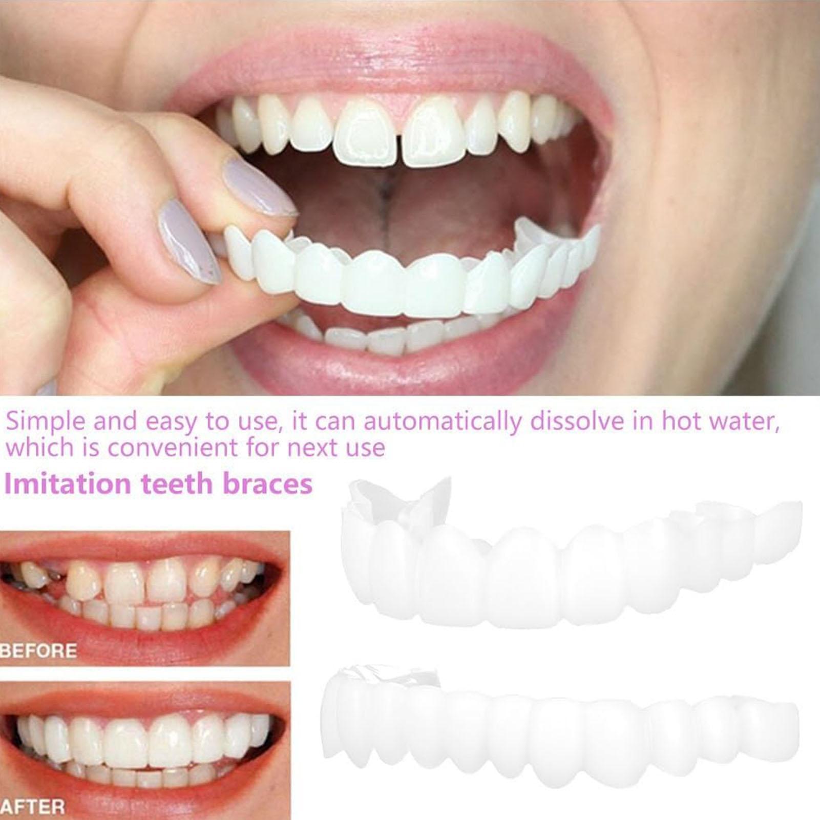 Dental Upper Lower Fake Teeth  - Teeth Whitening With Braces ulasan dan harga