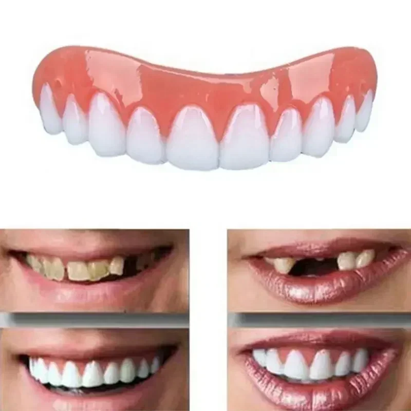 New False Teeth Silicone Upper - Teeth Whitening With Braces ulasan dan harga