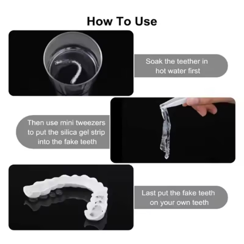Teeth Veneers Whitening Dentur - Teeth Whitening With Braces ulasan dan harga
