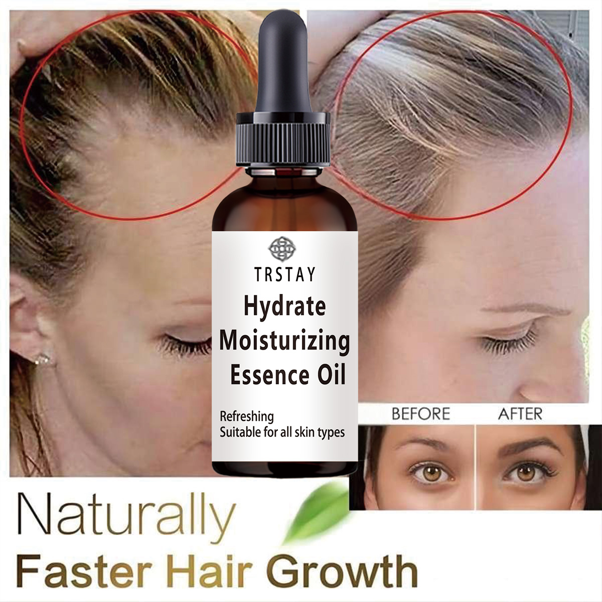 New Castor Oil Hair Growth Ess - Coconut Oil Pull ulasan dan harga