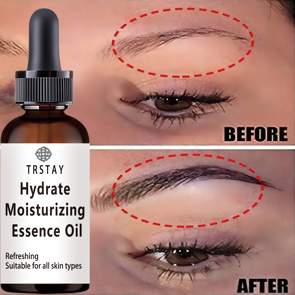 New Castor Oil Hair Growth Ess - Coconut Oil Pull ulasan dan harga