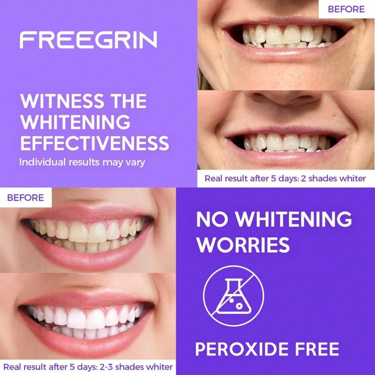 Deluxe Whitening Teeth Sticker - Teeth Whitening Ulta ulasan dan harga