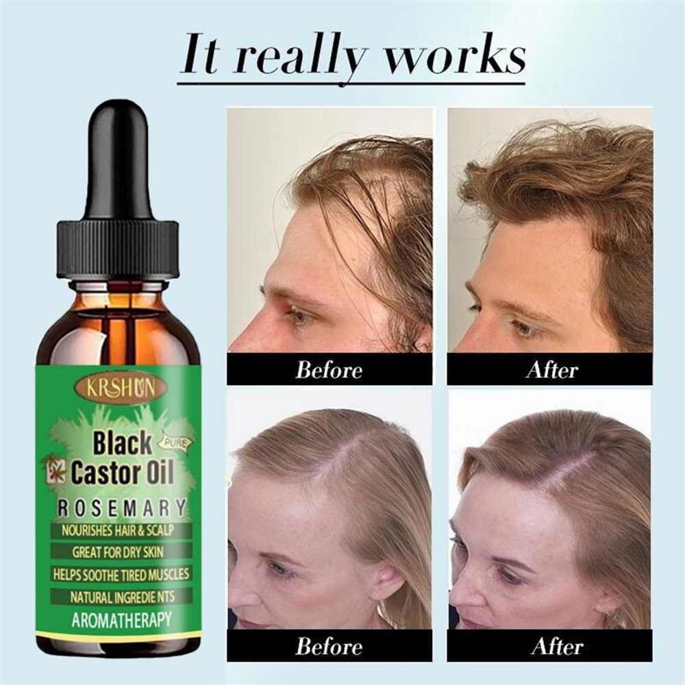 Black Castor Oil Nourishes Hai - Coconut Oil Pull ulasan dan harga