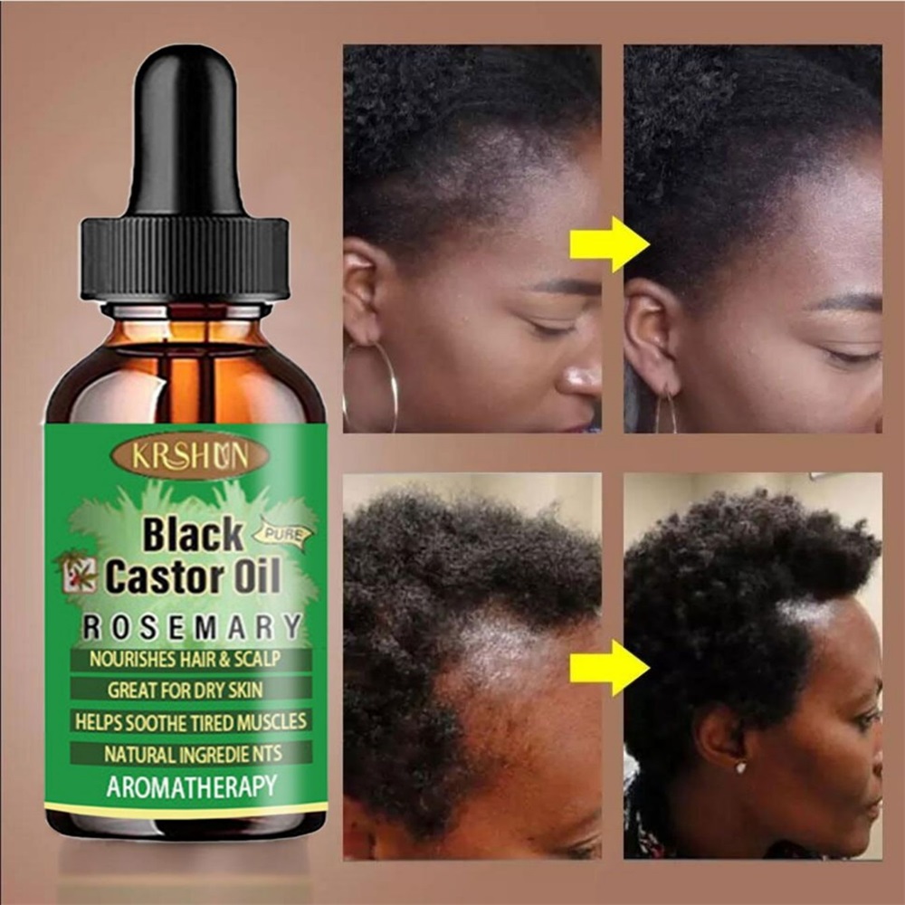 Black Castor Oil Nourishes Hai - Coconut Oil Pull ulasan dan harga