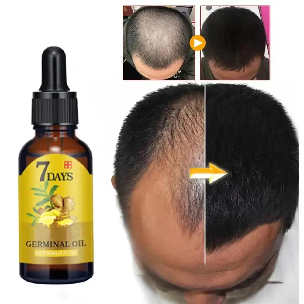 Hair Growth Ginger Fast Growin - Coconut Oil Pull ulasan dan harga