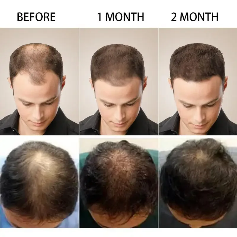 Hair Growth Ginger Fast Growin - Coconut Oil Pull ulasan dan harga